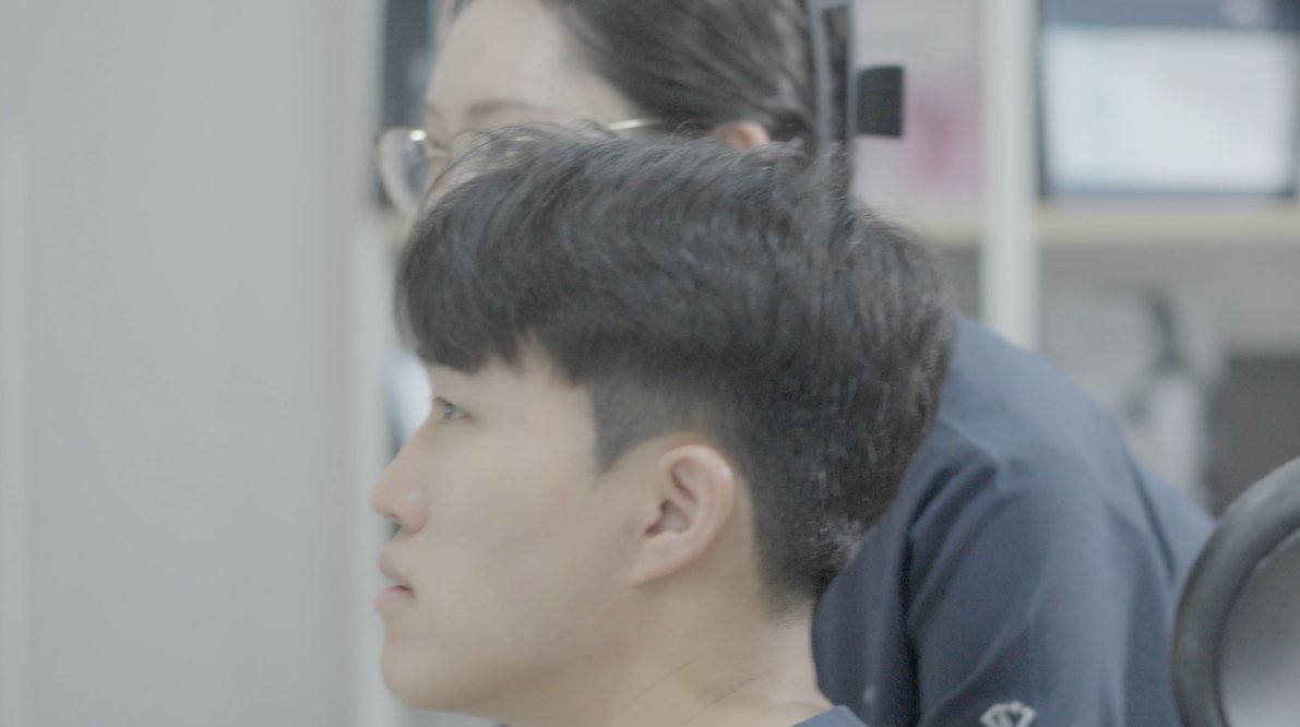 대전 티타늄리프팅 후기